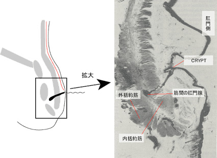 痔ろうの入り口の解剖