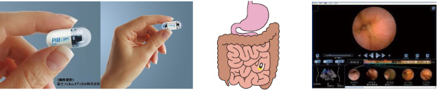カプセル内視鏡