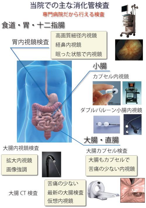 当院での消化管検査