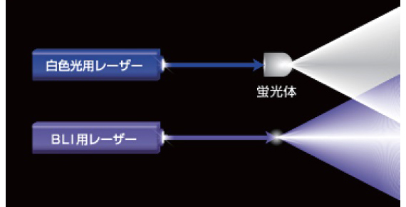 レーザー光源内視鏡システム