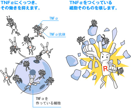 抗TNFα抗体とその作用