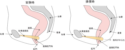 直腸肛門角