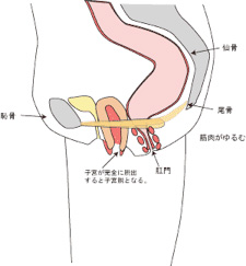 子宮脱