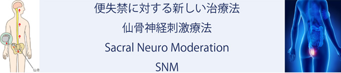 便失禁に対する新しい治療法　仙骨神経刺激療法（SNM）